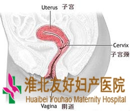 宫颈癌应该做哪些检查